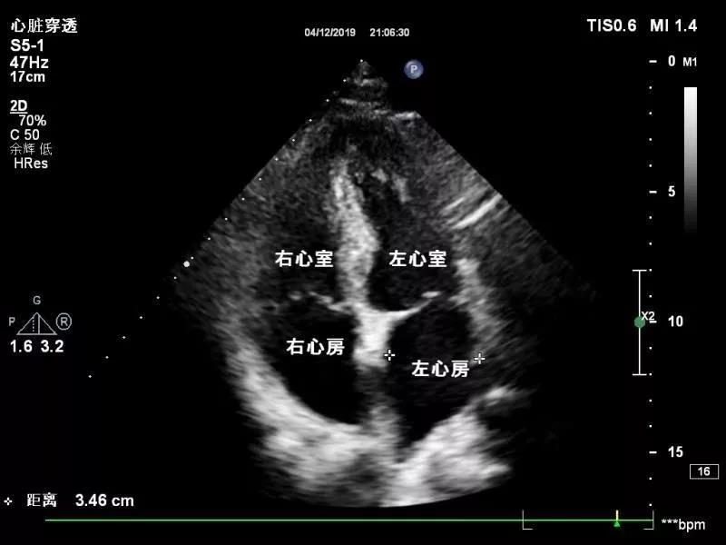 實力干貨|六條硬知識讓您變成心臟超聲的“行家”！轉給需要的人！！！